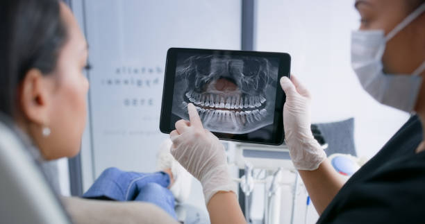 Licensed Tooth Extraction service in Tiburon, CA - Smile Center Dentistry